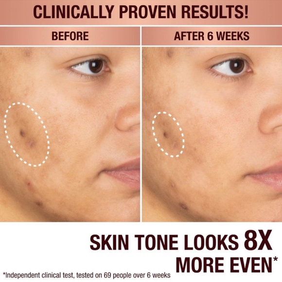 Charlotte Tilbury Dark Spot Correcting Radiance Recovery Serum 30ml - Picture 3 of 12